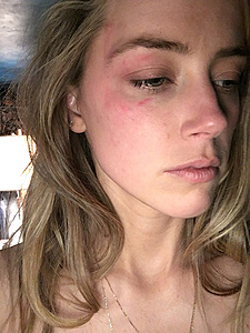 Нажмите на изображение для увеличения. 

Название:	amber-heard-e-435.jpg 
Просмотров:	372 
Размер:	95.6 Кб 
ID:	8718